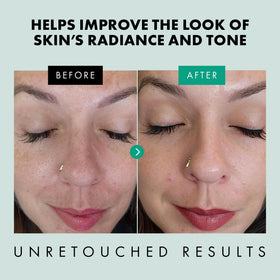 Eclat Skincare ingredient label close-up showing niacinamide and zinc PCA transparency benefit