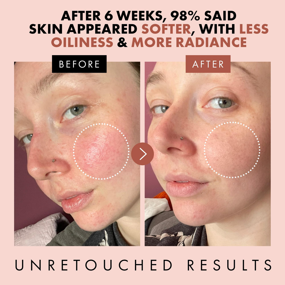Eclat Skincare rose petals and steam-distillation setup highlighting natural ingredients