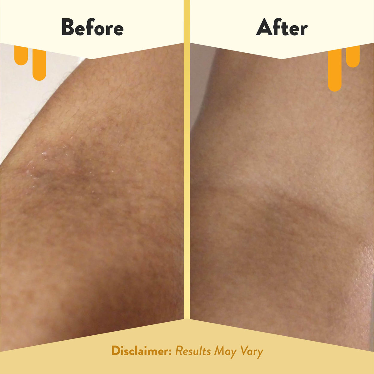 ECZEMA HONEY used as body wash in hand demonstrating gentle cleansing for sensitive skin