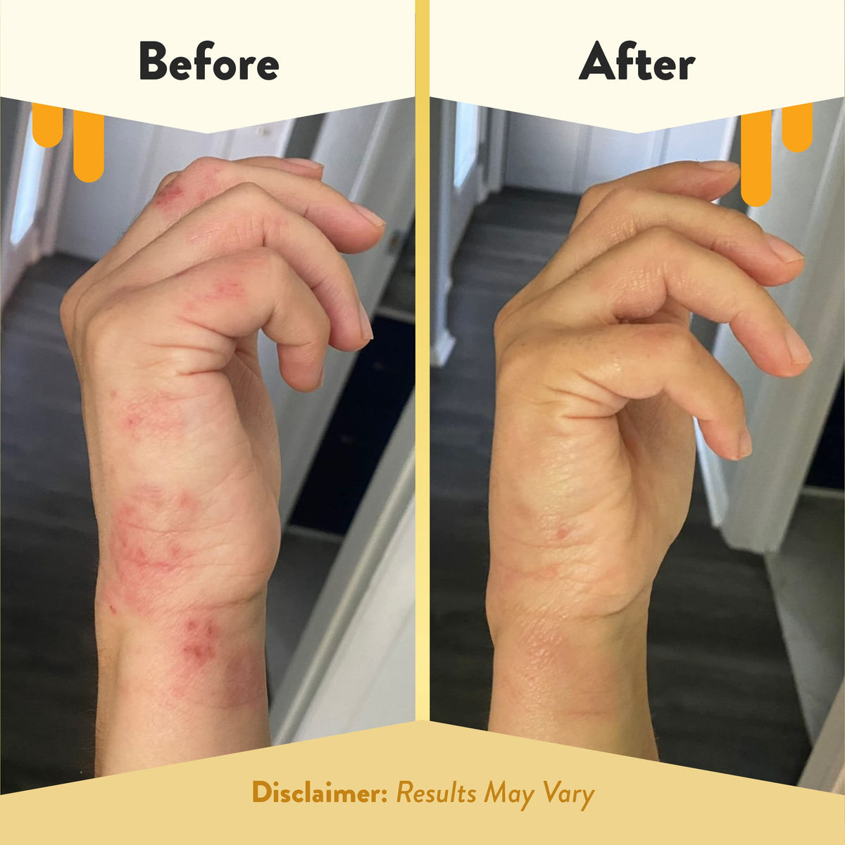 ECZEMA HONEY ingredients label detail highlighting natural oil blend benefits