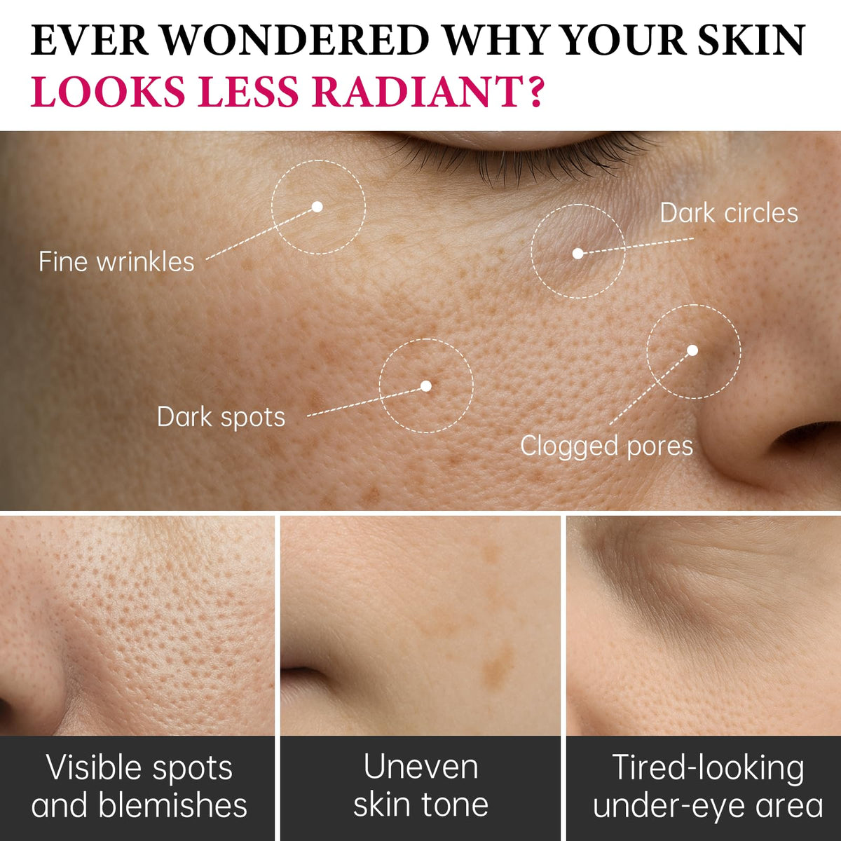 EELHOE open jar displaying creamy formula that evens skin tone
