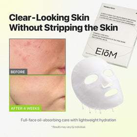 EIOM mask applied to model demonstrating full-face coverage and oil control