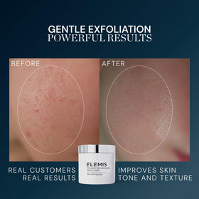 ELEMIS pad saturated with solution highlighting lactic acid and enzyme delivery benefit