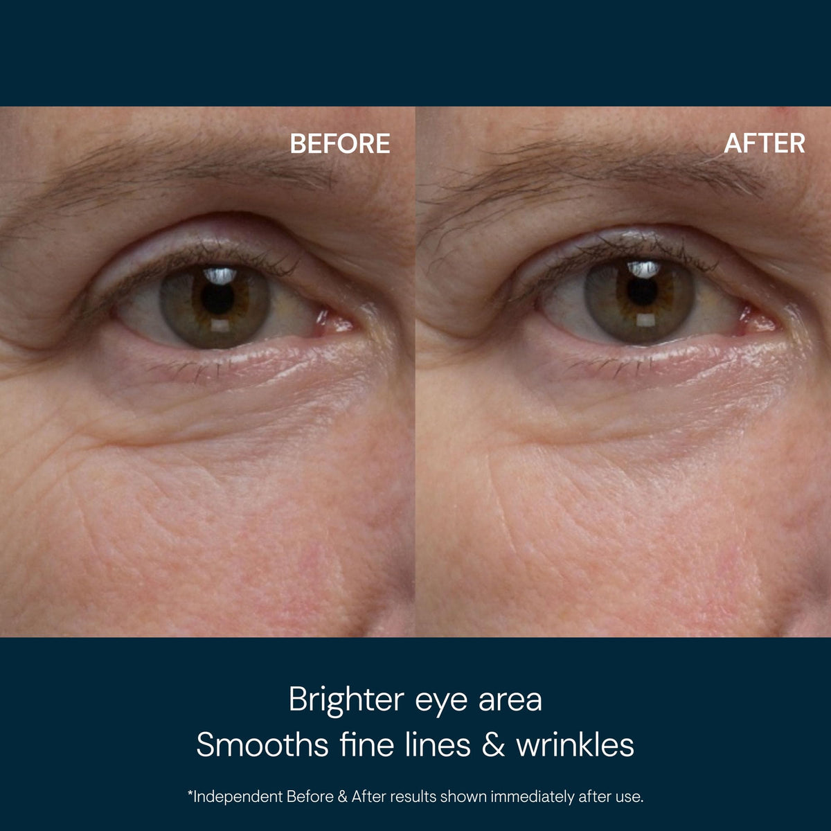 ELEMIS close-up of cooling gel texture highlighting rapid refresh and smoothing benefits