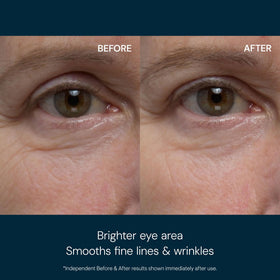 ELEMIS close-up of cooling gel texture highlighting rapid refresh and smoothing benefits