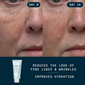ELEMIS open jar revealing gel-cream texture and quick-absorb benefit