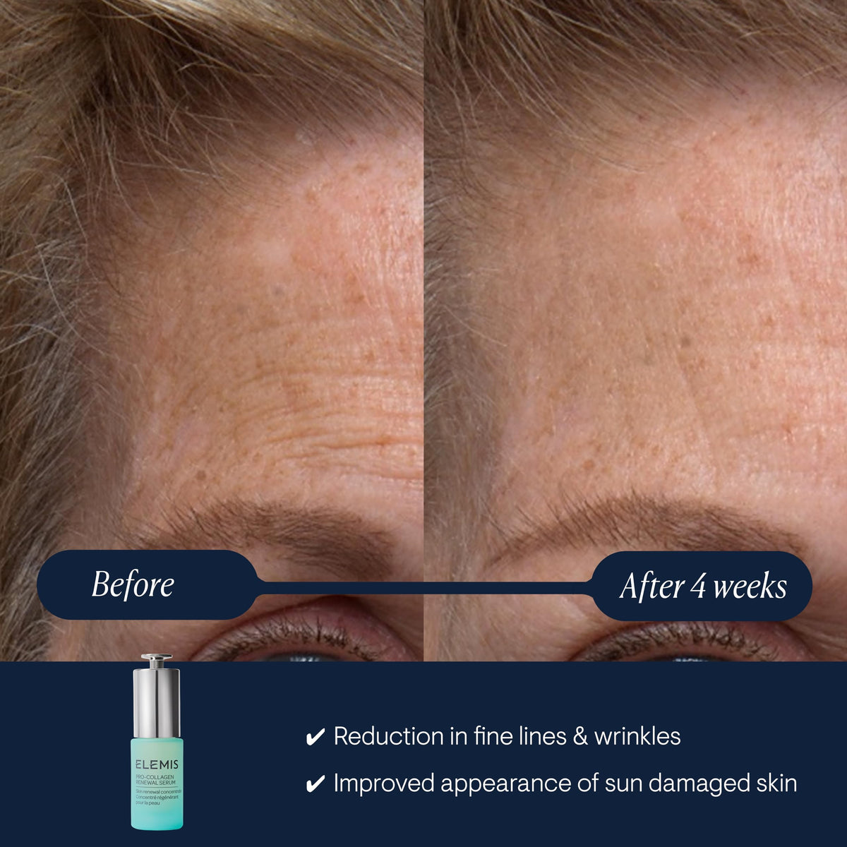 ELEMIS pipette dispensing serum highlighting precision and easy application