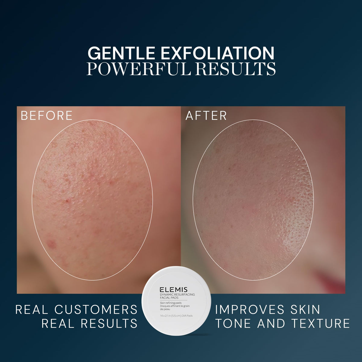ELEMIS smooth pad side detail for calming finish and even product application