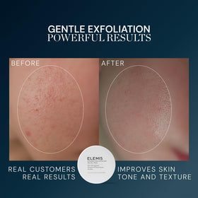 ELEMIS smooth pad side detail for calming finish and even product application