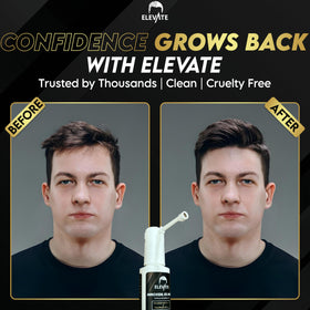 Elevate used on beard area highlighting targeted facial hair support