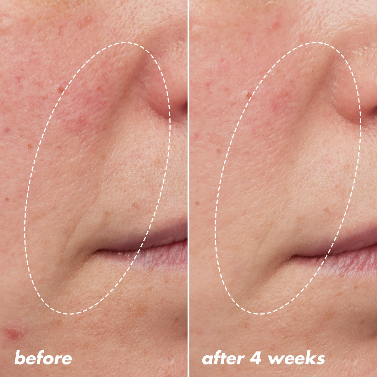 e.l.f. bottle label detail highlighting 1% granactive retinoid benefit