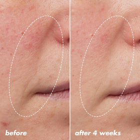 e.l.f. bottle label detail highlighting 1% granactive retinoid benefit
