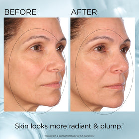 Elizabeth Arden before and after snapshot illustrating visible plumping and smoother skin benefit