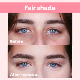 Elizabeth Mott before and after under-eye comparison showing brighter look
