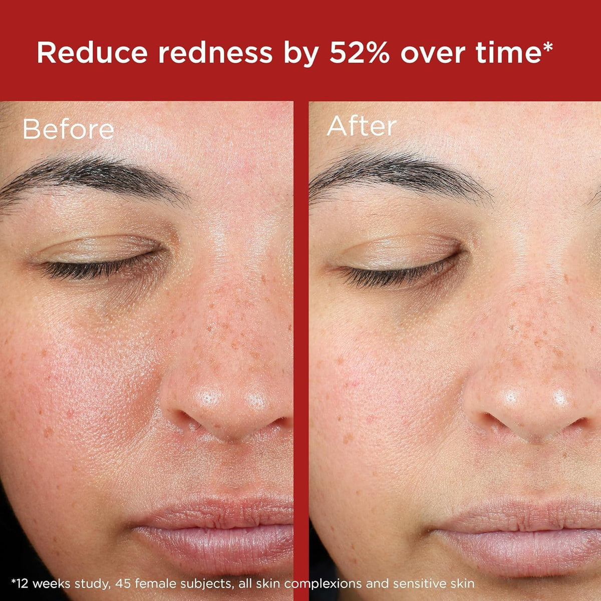 EltaMD applied to model cheek demonstrating blendability and even, natural finish