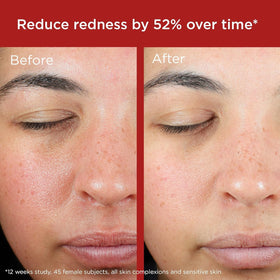 EltaMD applied to model cheek demonstrating blendability and even, natural finish