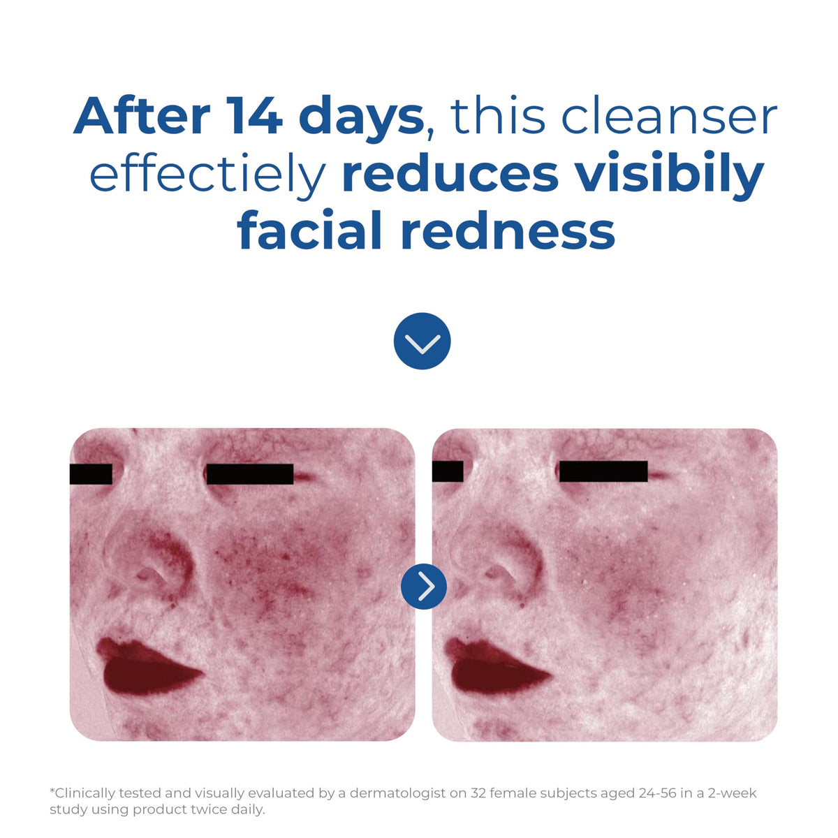 EltaMD label and claims closeup highlighting fragrance-free, noncomedogenic benefits