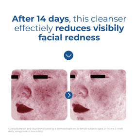 EltaMD label and claims closeup highlighting fragrance-free, noncomedogenic benefits