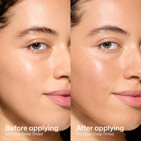 EltaMD label and ingredient list highlighting zinc oxide and niacinamide benefit