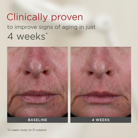 EltaMD in a morning routine setting demonstrating quick application and practical use