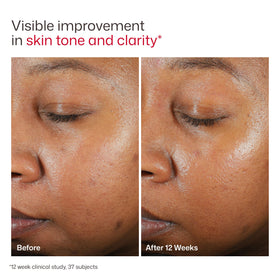 Face application of EltaMD under makeup for smooth layering and protection