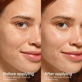 EltaMD product label close-up highlighting niacinamide and Zinc-AOX Pro