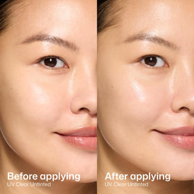 EltaMD UV Clear product label close-up showing key ingredients niacinamide