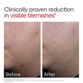 EltaMD worn under makeup showing smooth base and reduced shine