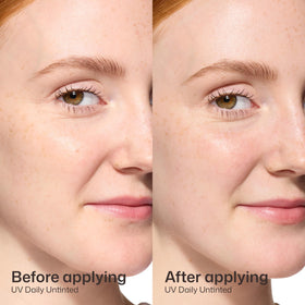 EltaMD ingredient label view, emphasizes zinc oxide and hyaluronic acid benefits