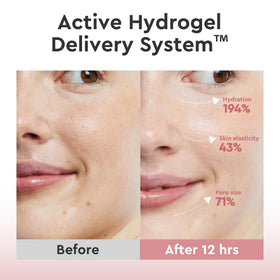 Elvira wearing the hydrogel mask in a nighttime skincare routine for hydration