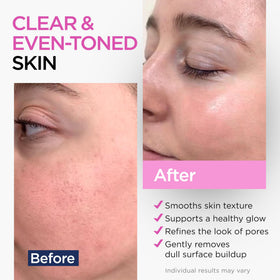 Ember Cloud serum dropper releasing a drop to show liquid texture and precise dosing benefit