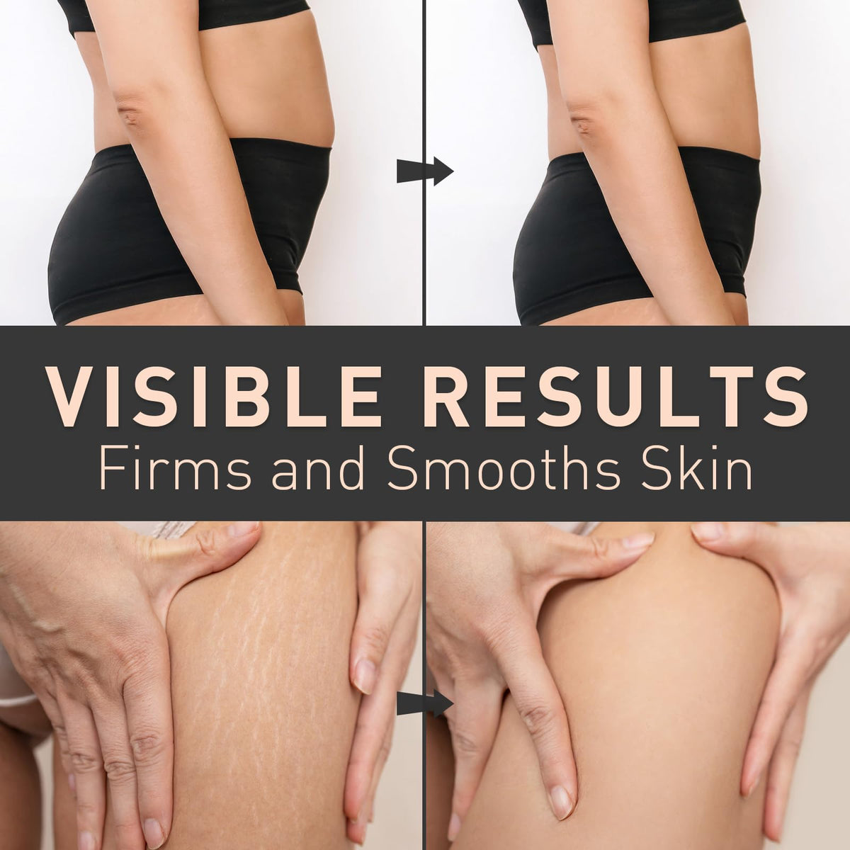 Enaskin Naturals applied to thighs and hips in a lifestyle scene suggesting improved texture and confidence