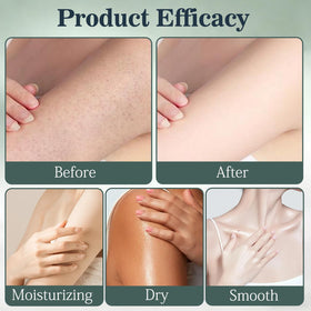 EOIRULA ingredients label displaying zinc oxide and undecylenic acid benefits