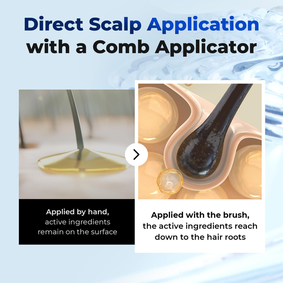 EPAIS being applied to scalp demonstrating targeted delivery and massage
