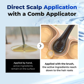 EPAIS being applied to scalp demonstrating targeted delivery and massage