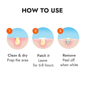 Epielle lifestyle on bathroom vanity showing easy, everyday acne care