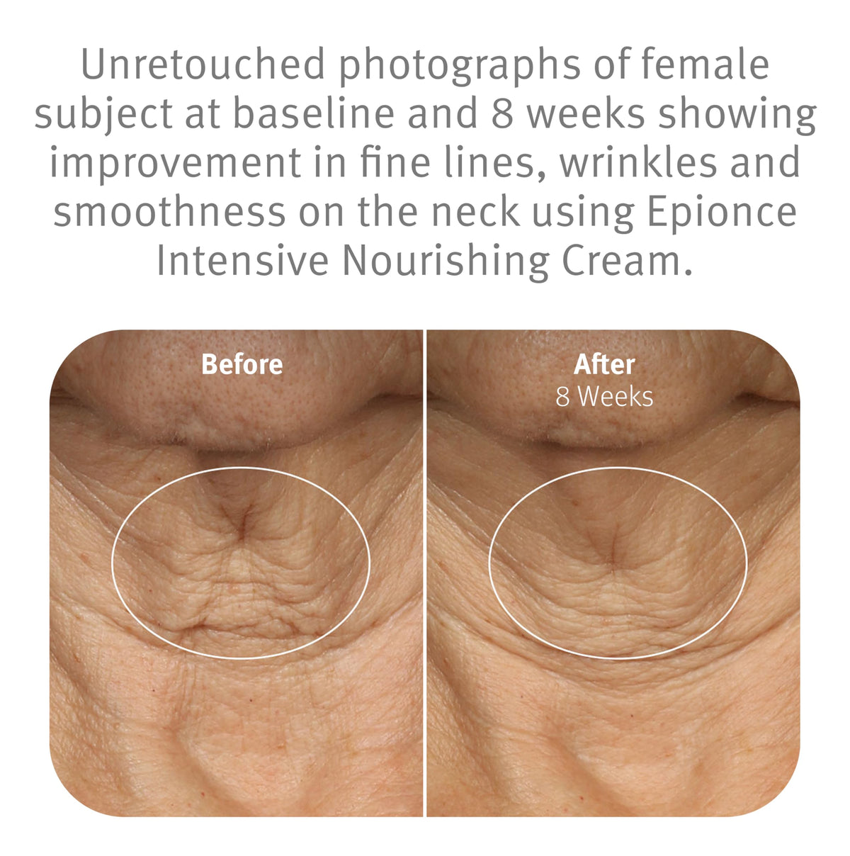 Model applying Epionce cream to neck and décolletage to illustrate targeted hydration benefits