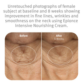 Model applying Epionce cream to neck and décolletage to illustrate targeted hydration benefits