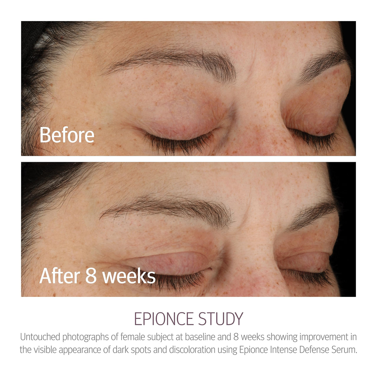 Epionce pipette dispensing serum showcasing precise, non-wasteful application
