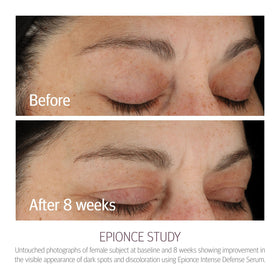 Epionce pipette dispensing serum showcasing precise, non-wasteful application