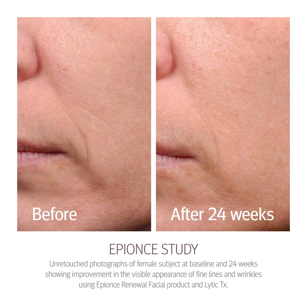 Epionce lotion dispensed on hand highlighting lightweight hydration benefit