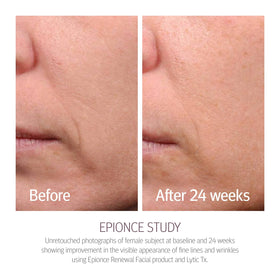 Epionce lotion dispensed on hand highlighting lightweight hydration benefit