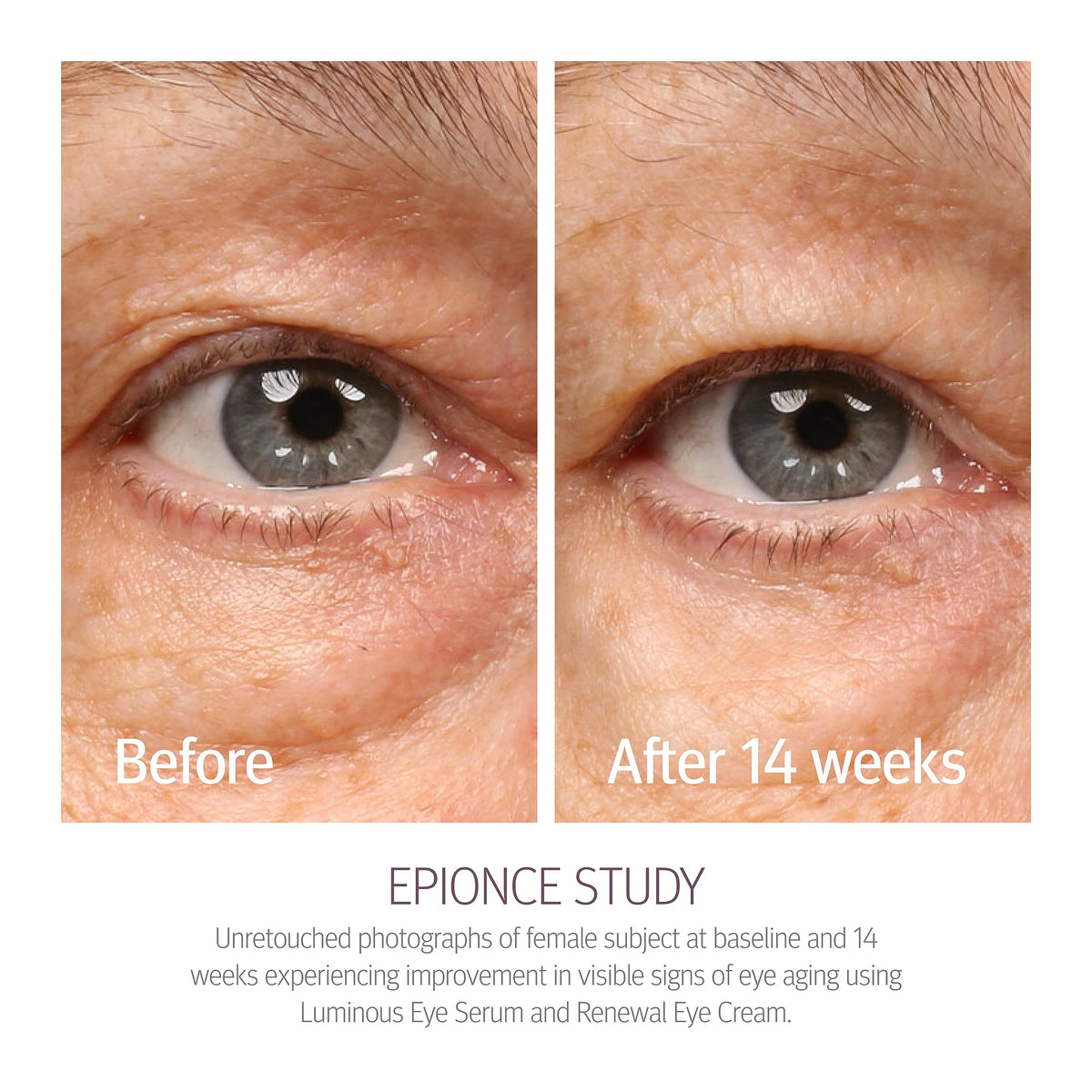 Epionce Renewal Eye Cream key ingredients plated to show calming and hydrating benefits