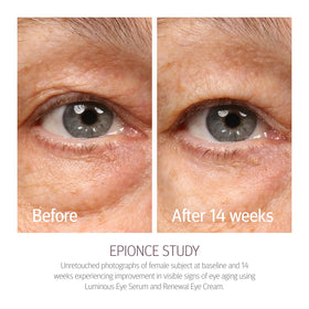 Epionce Renewal Eye Cream key ingredients plated to show calming and hydrating benefits
