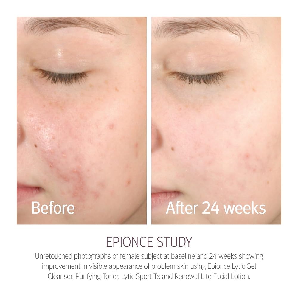 Epionce texture close-up reveals smooth lotion that absorbs quickly for matte finish