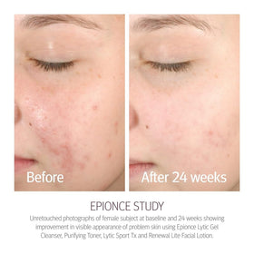 Epionce texture close-up reveals smooth lotion that absorbs quickly for matte finish
