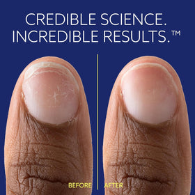 epres ePhD application on natural nail illustrating strengthened nail edge after use