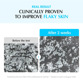 EQQUALBERRY before and after skin texture comparison showing visible smoothing