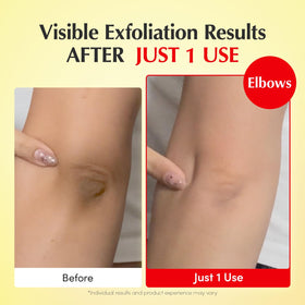 EQQUALBERRY bromelain enzyme depiction showing gentle exfoliation benefit