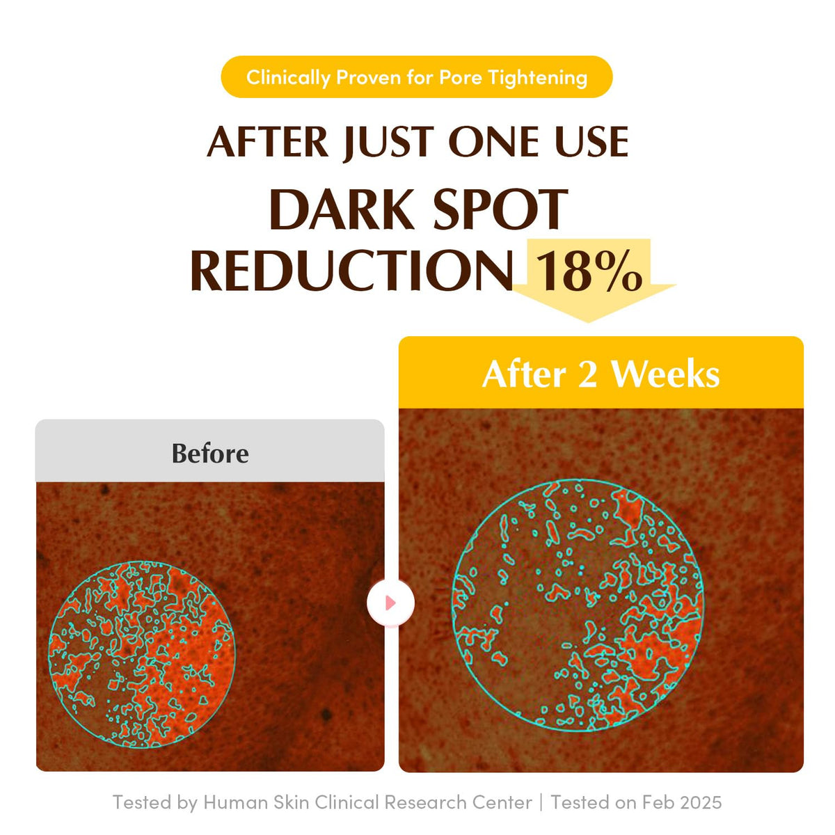 EQQUALBERRY mask edges fitting face to prevent evaporation and increase uptake
